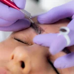 Narben nach Microblading Permanent Make-Up